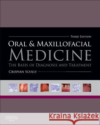 Oral and Maxillofacial Medicine: The Basis of Diagnosis and Treatment Scully, Crispian 9780702049484