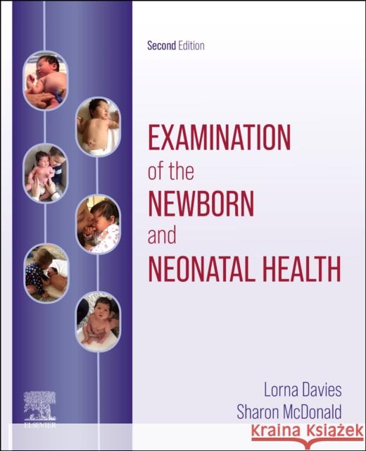 Examination of the Newborn and Neonatal Health: A Multidimensional Approach Lorna Davies Sharon McDonald 9780702049552 Churchill Livingstone