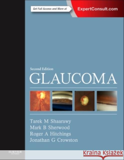 Glaucoma : 2-Volume Set Tarek Shaarawy 9780702051937 Elsevier Saunders