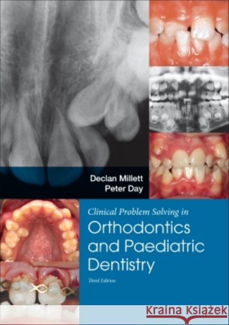 Clinical Problem Solving in Dentistry: Orthodontics and Paediatric Dentistry Declan Millett Peter Day 9780702058363 Churchill Livingstone