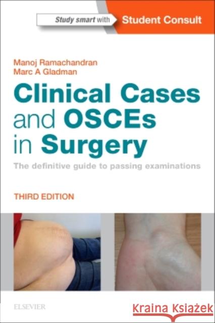 Clinical Cases and OSCEs in Surgery: The definitive guide to passing examinations Marc A, MBBS DRCOG DFFP PhD MRCOG MRCS (Eng) FRCS (Gen Surg, UK) FRACS Gladman 9780702066290 Elsevier