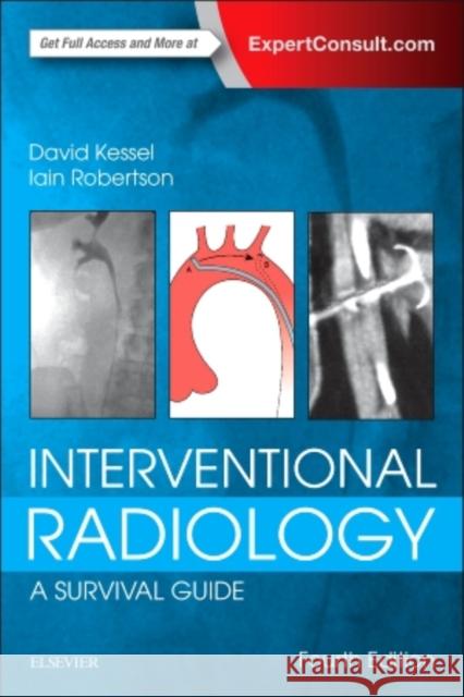 Interventional Radiology: A Survival Guide David Kessel Iain Robertson 9780702067303