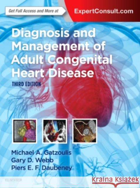 Diagnosis and Management of Adult Congenital Heart Disease Michael A. Gatzoulis Gary D. Webb Piers E. F. Daubeney 9780702069291