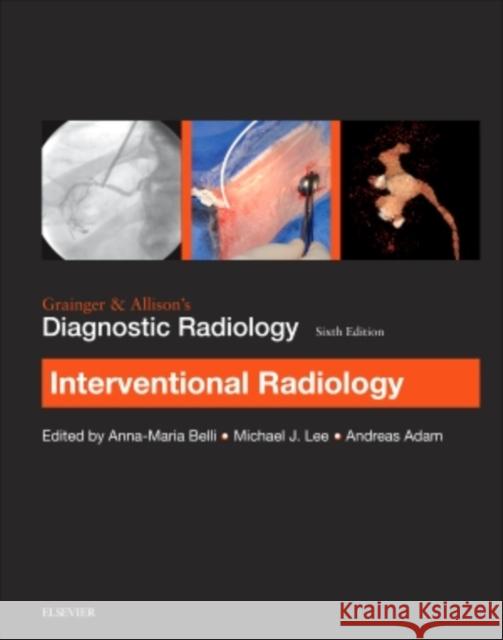 Grainger & Allison's Diagnostic Radiology: Interventional Imaging Anna Marie Belli Michael J. Lee Andy Adam 9780702069338 Elsevier