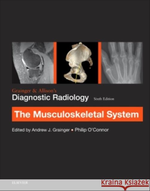 Grainger & Allison's Diagnostic Radiology: Musculoskeletal System Andrew J. Grainger Philip J. O'Connor  9780702069369