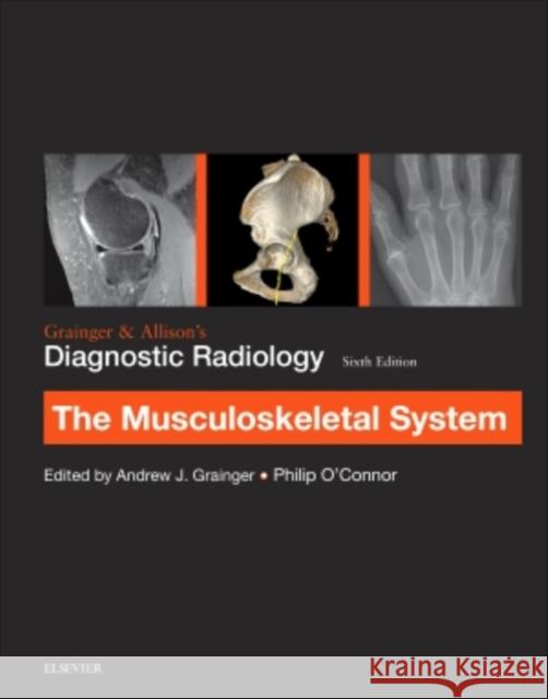 Grainger & Allison's Diagnostic Radiology: Musculoskeletal System Andrew J. Grainger Philip J. O'Connor  9780702069369 Elsevier Health Sciences