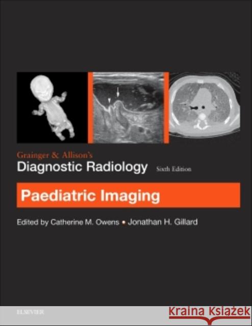 Grainger & Allison's Diagnostic Radiology: Paediatric Imaging Catherine Owens Jonathan H. Gillard 9780702069390