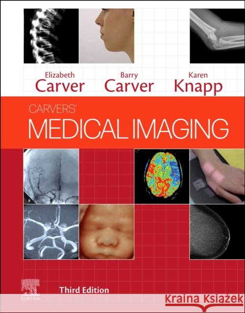 Carvers' Medical Imaging Elizabeth Carver Barry Carver Karen Knapp 9780702069550