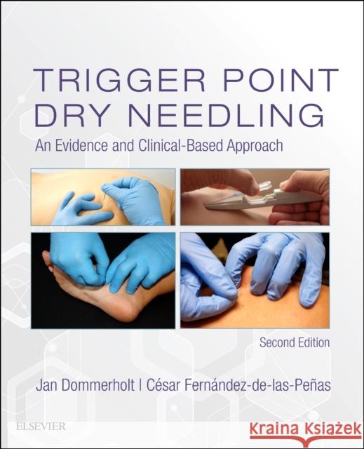 Trigger Point Dry Needling: An Evidence and Clinical-Based Approach Dommerholt, Jan 9780702074165 Elsevier Health Sciences