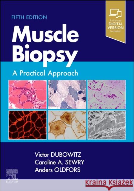 Muscle Biopsy: A Practical Approach Anders Oldfors Caroline A. Sewry  9780702074714 Elsevier Health Sciences