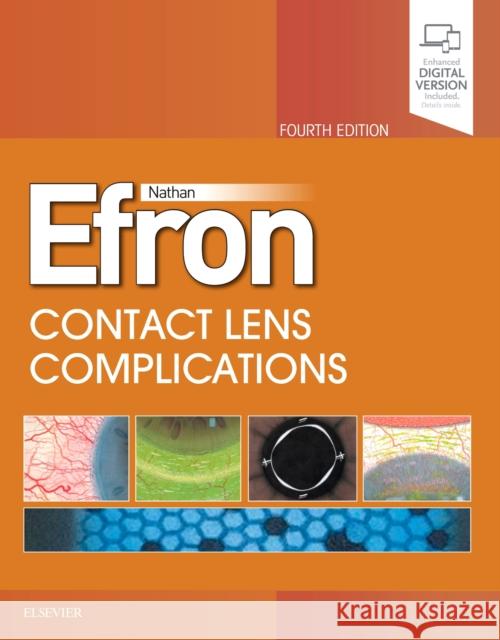 Contact Lens Complications Nathan Efron   9780702076114 Elsevier Health Sciences