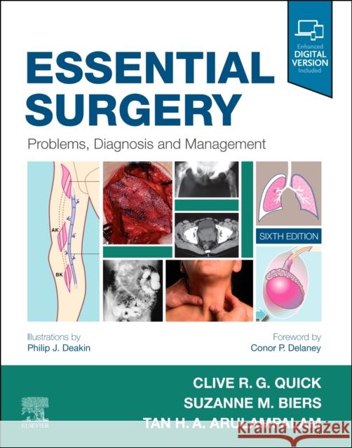 Essential Surgery: Problems, Diagnosis and Management Clive R. G. Quick Tan Arulampalam Suzanne Biers 9780702076312 Elsevier Health Sciences