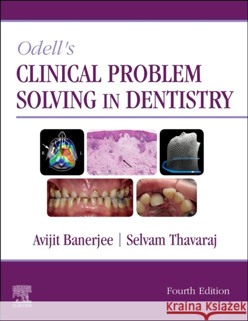 Odell's Clinical Problem Solving in Dentistry Avijit Banerjee Selvam Thavaraj 9780702077005