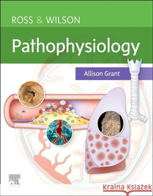 Ross & Wilson Pathophysiology Allison, BSc PhD RGN (Department of Biological and Biomedical Sciences, Glasgow Caledonian University, Glasgow, UK) Gran 9780702077715 Elsevier Health Sciences