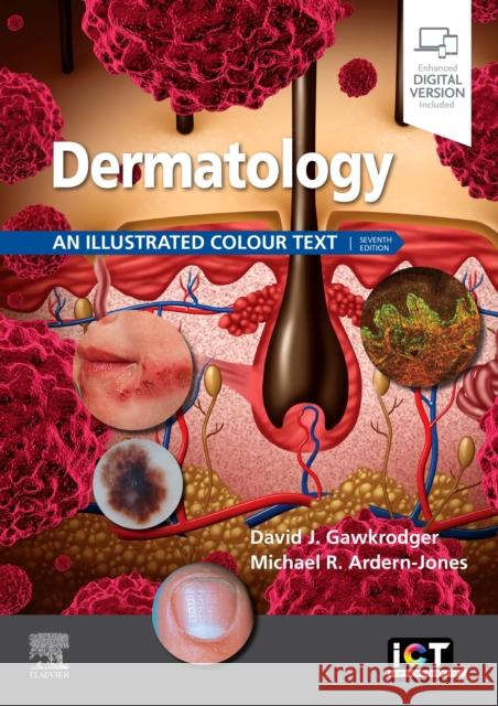 Dermatology: An Illustrated Colour Text Michael R. (Professor and Consultant Dermatologist, University of Southampton, Southampton General Hospital, Southampton 9780702079962