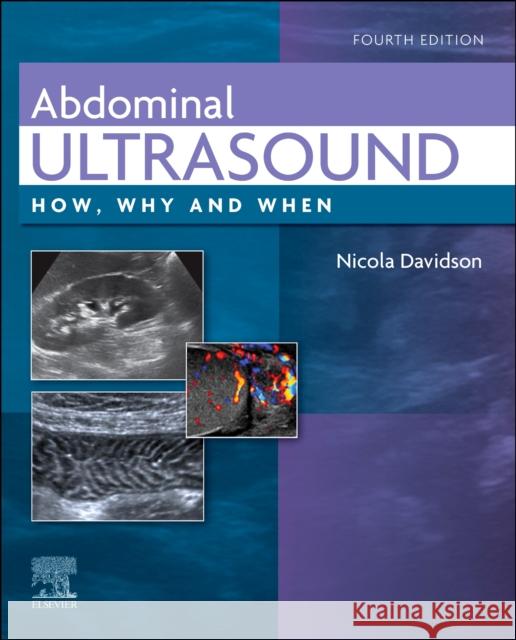 Abdominal Ultrasound: How, Why and When Davidson, Nicola 9780702082436 Elsevier Health Sciences