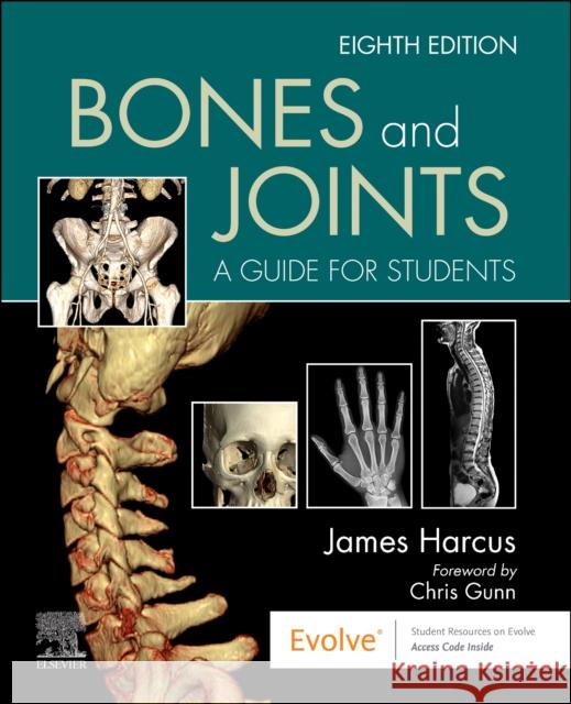 Bones and Joints: A Guide for Students James (Lecturer in Diagnostic Imaging, University of Leeds, UK) Harcus 9780702084300 Elsevier Health Sciences