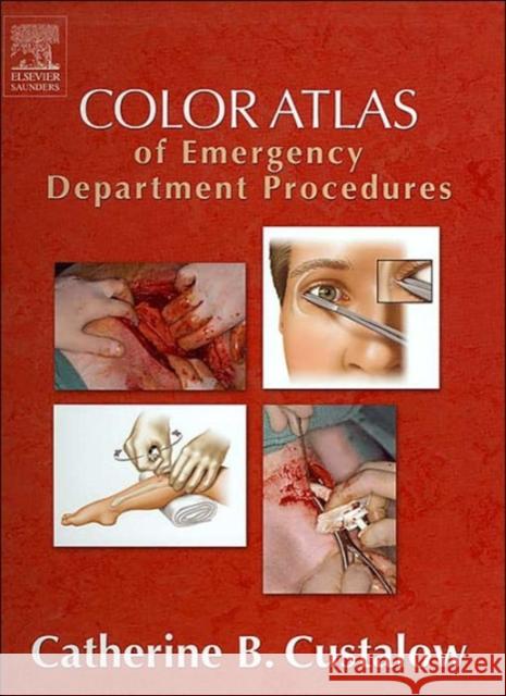Color Atlas of Emergency Department Procedures Catherine B. Custalow 9780721604473 W.B. Saunders Company