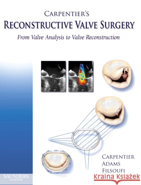 Carpentier's Reconstructive Valve Surgery: From Valve Analysis to Valve Reconstruction Carpentier, Alain 9780721691688 Elsevier Health Sciences