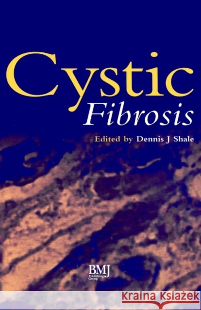 Cystic Fibrosis Dennis J. Shale 9780727908261 Bmj Publishing Group