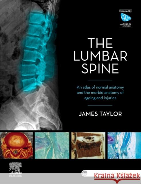 The Lumbar Spine: An Atlas of Normal Anatomy and the Morbid Anatomy of Ageing and Injury James Taylor 9780729543132 Elsevier Australia