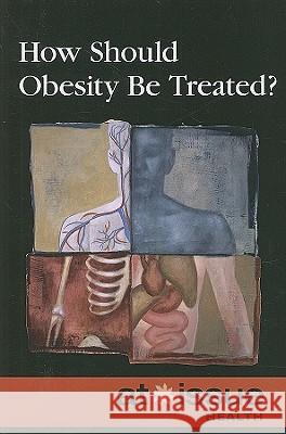How Should Obesity Be Treated? Stefan Kiesbye 9780737744231 Greenhaven Press