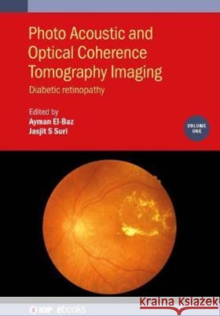 Photo Acoustic and Optical Coherence Tomography Imaging: Diabetic Retinopathy El-Baz, Ayman 9780750320504 IOP Publishing Ltd