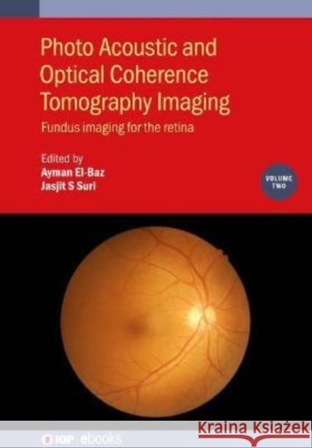 Photo Acoustic and Optical Coherence Tomography Imaging: Fundus Imaging for the Retina Ayman El-Baz Jasjit S. Suri 9780750320542 IOP Publishing Ltd