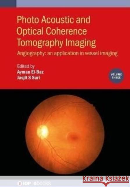 Photo Acoustic and Optical Coherence Tomography Imaging, Volume 3: Angiography: an application in vessel imaging El-Baz, Ayman 9780750320580 IOP Publishing Ltd