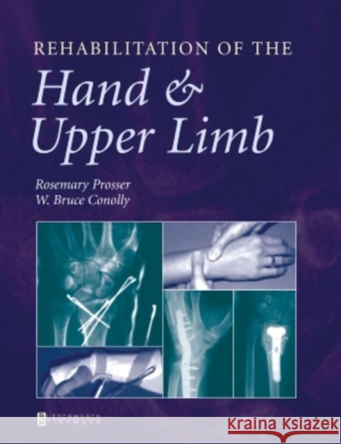 Rehabilitation of the Hand and Upper Limb Prosser                                  Rosemary Prosser W. Bruce Conolly 9780750622639 Butterworth-Heinemann