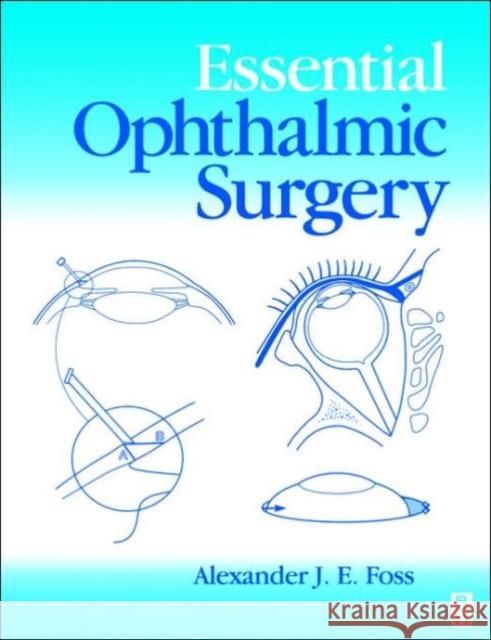 ESSENTIAL OPHTHALMIC SURGERY Alexander J. E. (Consultant Ophthalmic Surgeon, Univer Foss 9780750641975 ELSEVIER HEALTH SCIENCES