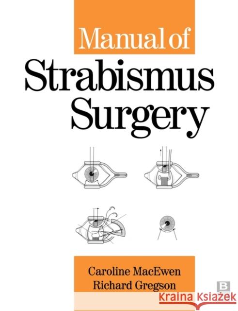 Manual of Strabismus Surgery Macewen                                  Gregson                                  Caroline Macewen 9780750652483 Butterworth-Heinemann