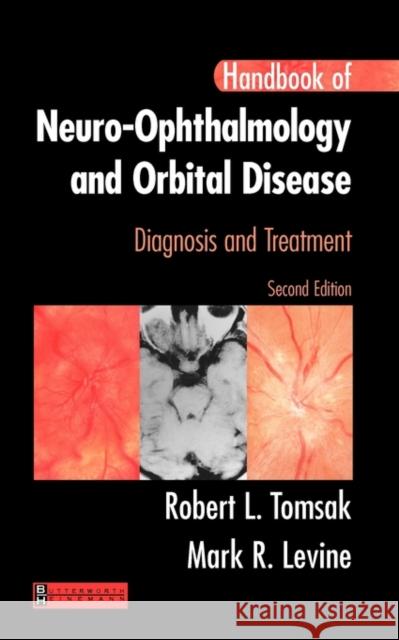 Handbook of Neuro-Ophthalmology: Diagnosis and Treatment Tomsak, Robert L. 9780750674171 Butterworth-Heinemann