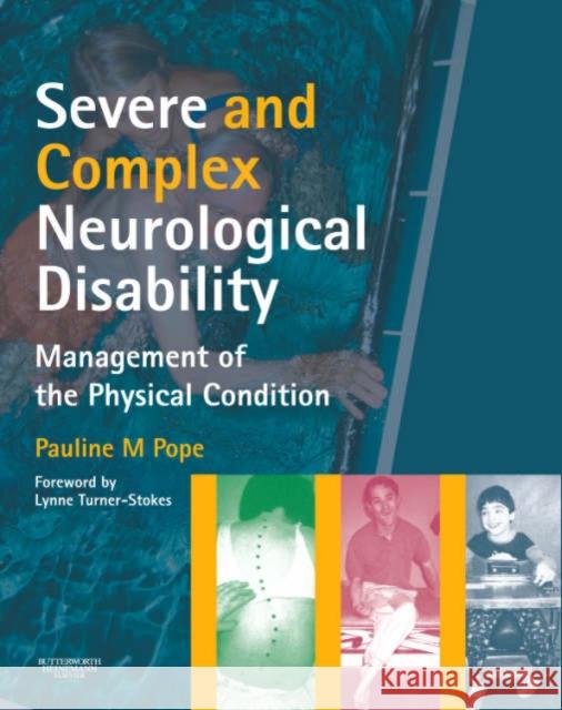 Severe and Complex Neurological Disability: Management of the Physical Condition Pope, Pauline M. 9780750688253 Butterworth-Heinemann