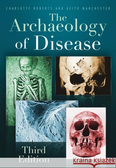 The Archaeology of Disease: Third Edition Charlotte Roberts 9780752457505