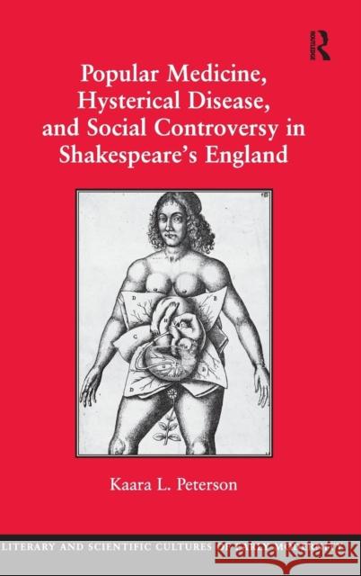 Popular Medicine, Hysterical Disease, and Social Controversy in Shakespeare's England Kaara Peterson   9780754669937