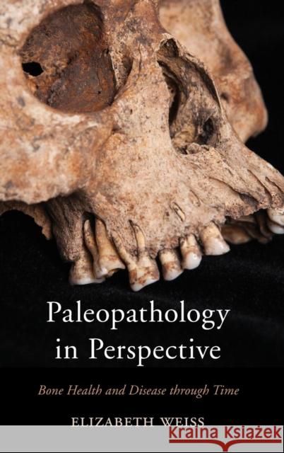 Paleopathology in Perspective: Bone Health and Disease through Time Weiss, Elizabeth 9780759124035 Rowman & Littlefield Publishers