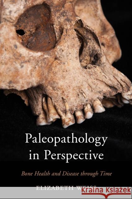 Paleopathology in Perspective: Bone Health and Disease Through Time Elizabeth Weiss 9780759124424 Rowman & Littlefield Publishers