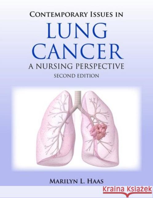 Contemporary Issues in Lung Cancer: A Nursing Perspective Haas, Marilyn 9780763760519 Jones & Bartlett Publishers