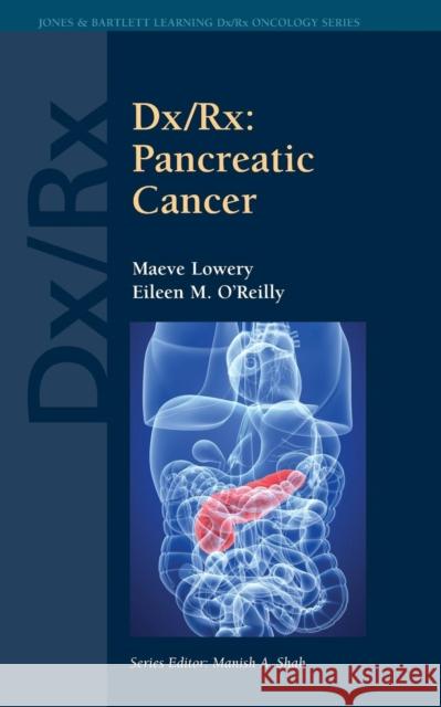 DX/Rx: Pancreatic Cancer: Pancreatic Cancer Lowery, Maeve 9780763780654 Jones & Bartlett Publishers