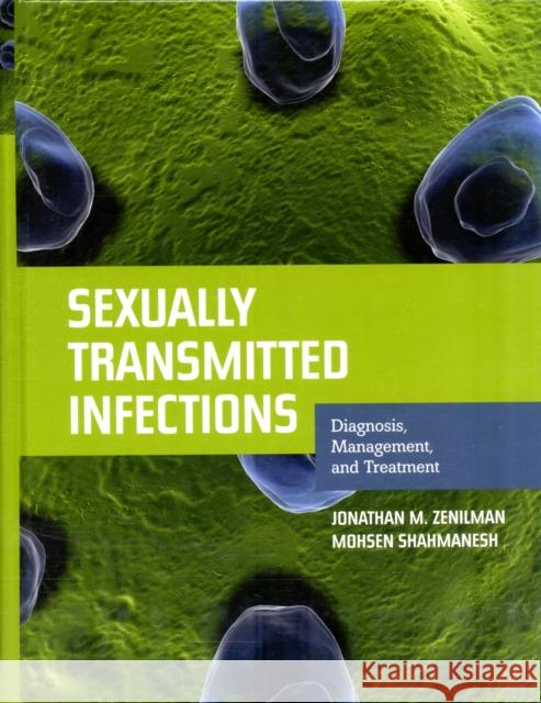 Sexually Transmitted Infections: Diagnosis, Management, and Treatment: Diagnosis, Management, and Treatment Zenilman, Jonathan M. 9780763786755 Jones & Bartlett Publishers