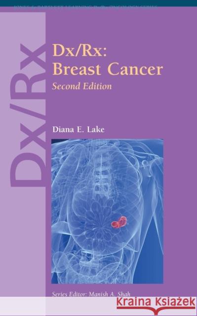 DX/Rx: Breast Cancer: Breast Cancer Lake, Diana E. 9780763794330 Jones & Bartlett Publishers