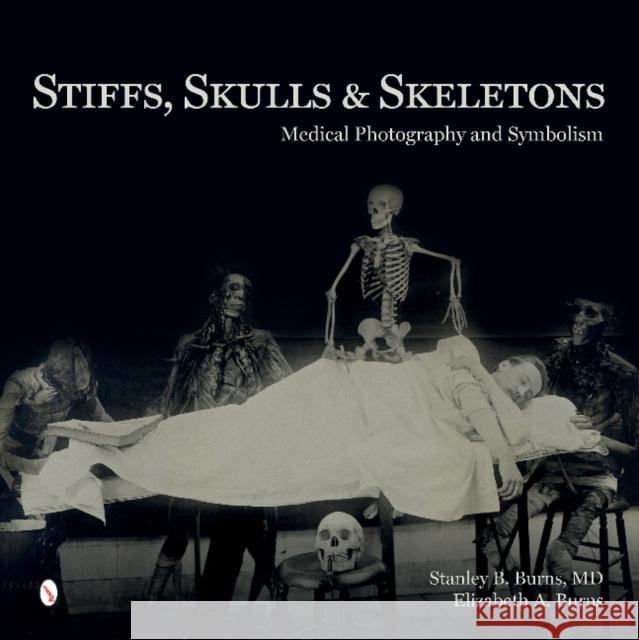 Stiffs, Skulls & Skeletons: Medical Photography and Symbolism MD Burns Elizabeth A. Burns Stanley B. Burn 9780764347467
