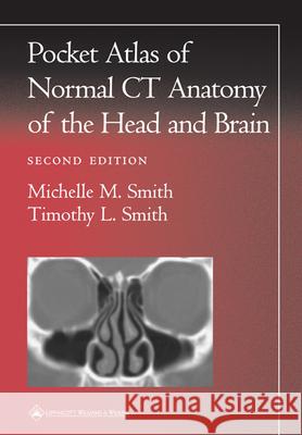 Pocket Atlas of Normal CT Anatomy of the Head and Brain Anton N Hasso 9780781729499 0