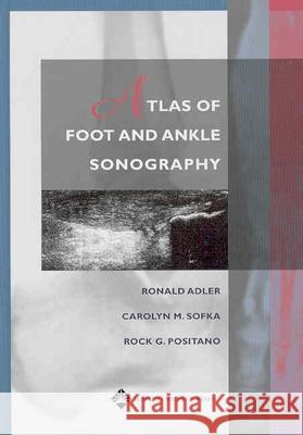 Atlas of Foot and Ankle Sonography Ronald Adler Carolyn M. Solka Rock G. Positano 9780781747691