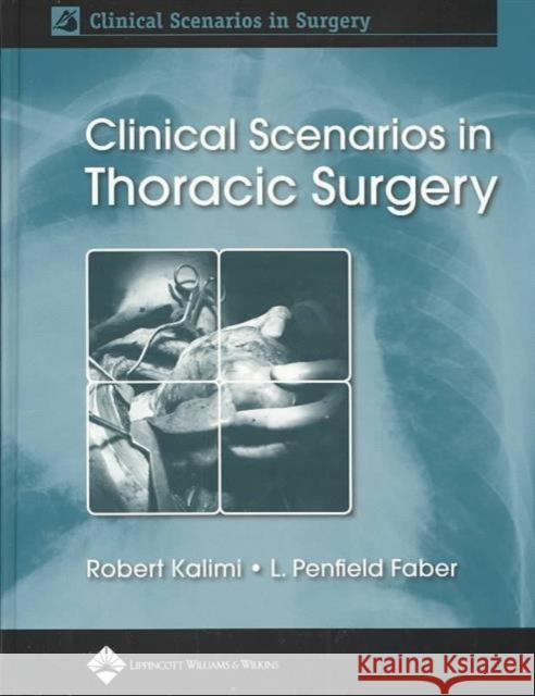 Clinical Scenarios in Thoracic Surgery Robert Kalimi L. Penfield Faber 9780781747974 Lippincott Williams & Wilkins