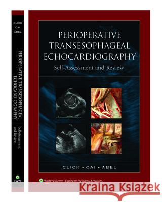 Perioperative Transesophageal Echocardiography Self-Assessment and Review Roger L. Click Joy X. Cai Martin D. Abel 9780781755764 Lippincott Williams & Wilkins