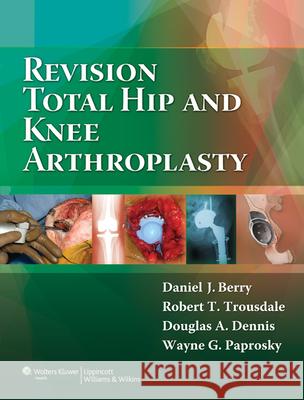 Revision Total Hip and Knee Arthroplasty Daniel Berry 9780781760430 LIPPINCOTT WILLIAMS & WILKINS