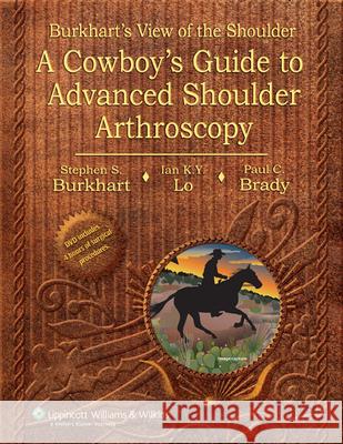 Burkhart's View of the Shoulder : A Cowboy's Guide to Advanced Shoulder Arthroscopy Stephen S Burkhart 9780781780001 0