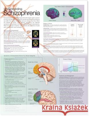 Understanding Schizophrenia Anatomical Chart  Anatomical Chart Company 9780781786423 0